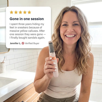 Nue Electric Callus Remover