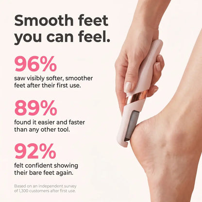 Nue Electric Callus Remover