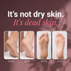 Nue Electric Callus Remover